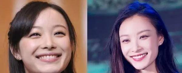 李沁镶一口"金牙",笑容再美也看不下去,牙白后气质的确不一样_牙齿