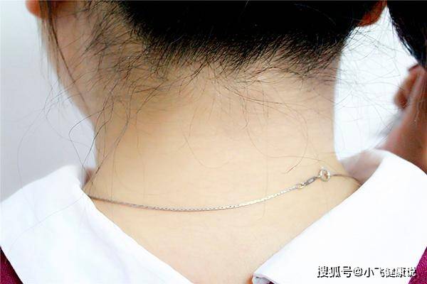 马犬脖子有白毛好不好