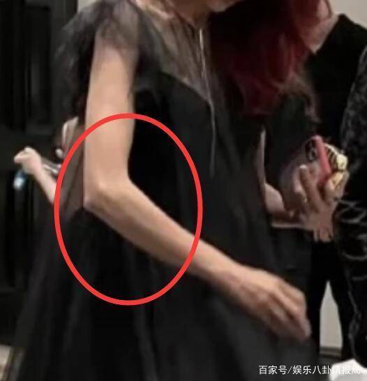 如何瘦手指又细又长 6033d83ef59249d3a71ffc1972d2650a.jpeg