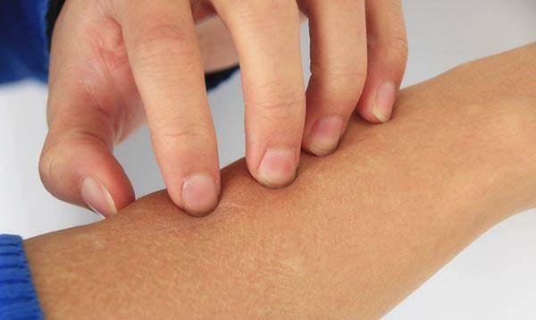 身上瘙痒是肝脏的原因吗 c64ec6c3a0214a87a70af38fc5b6aab1.jpeg