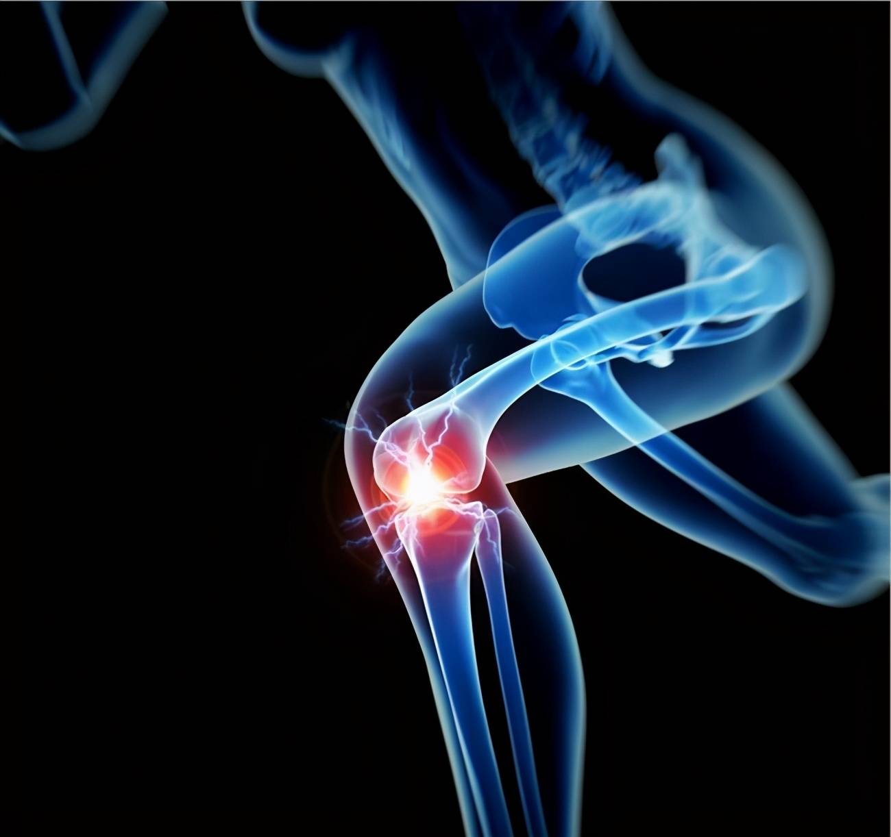 膝关节二度损伤算严重吗 韧带二度损伤康复时间