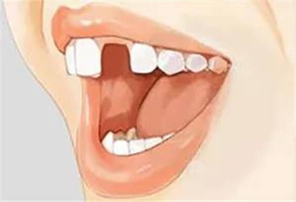 种牙最好时间段 4d0cb86e9fea48958d388ace1f462ee2.jpeg