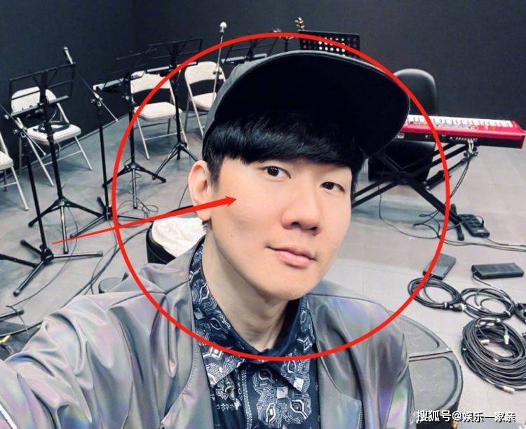 林俊杰终于鼓起勇气掀刘海,看清他的大脑门后,粉丝差点没认出来