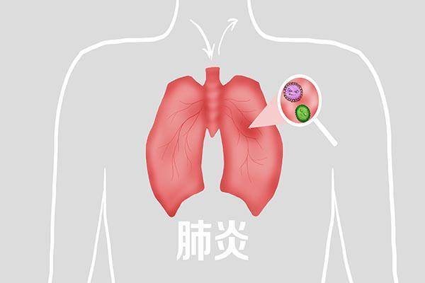 原創咳出黃痰黑痰白痰分別說明了啥嚥下去的痰都去哪了