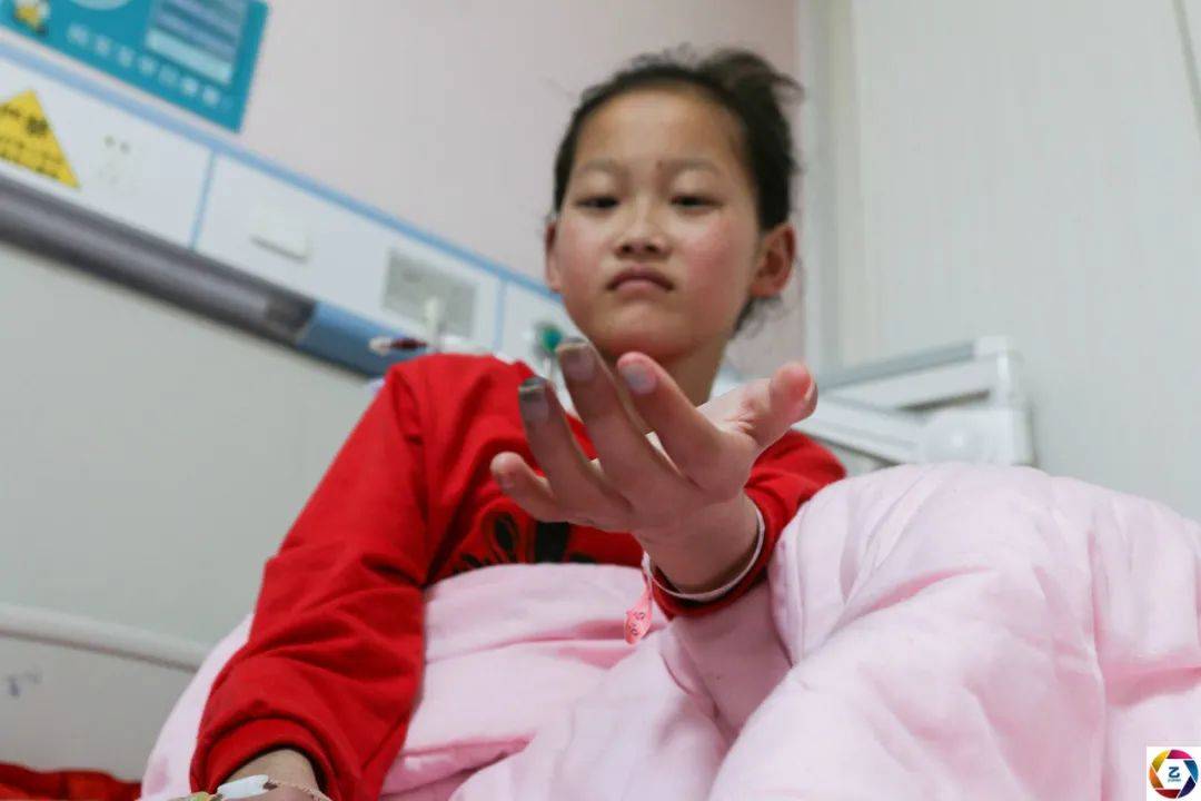 花季少女患怪病手脚从指头开始碳化变黑看到检查结果爸妈崩溃