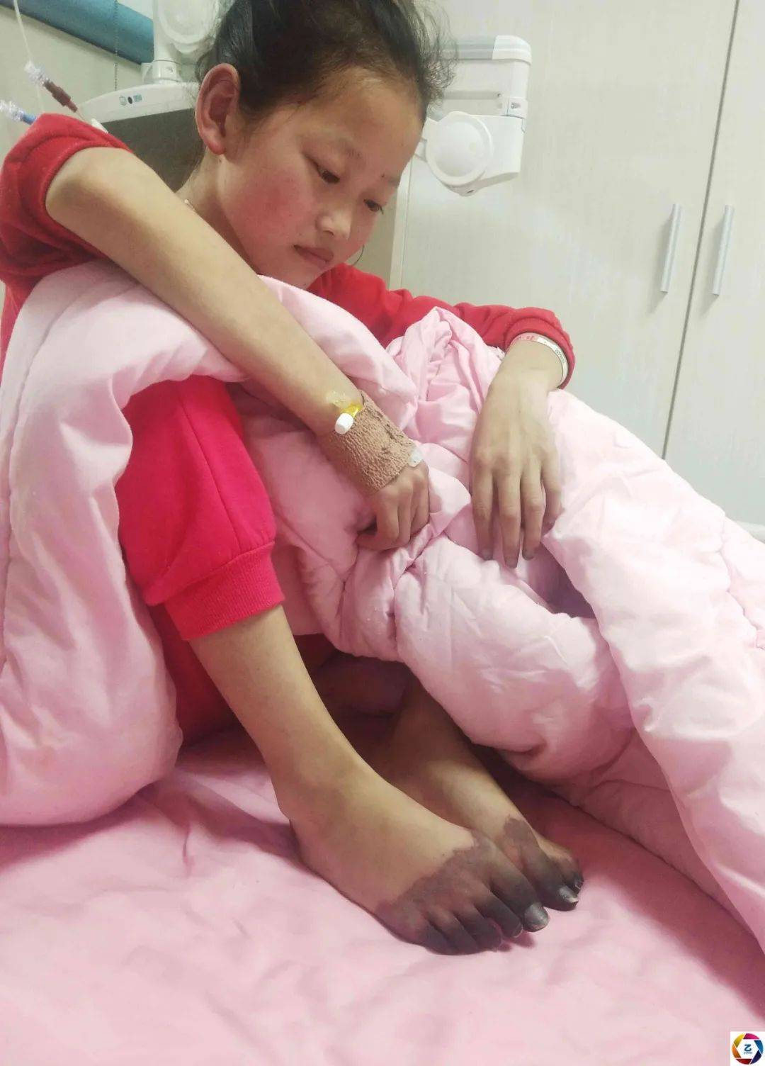 花季少女患怪病手脚从指头开始碳化变黑看到检查结果爸妈崩溃