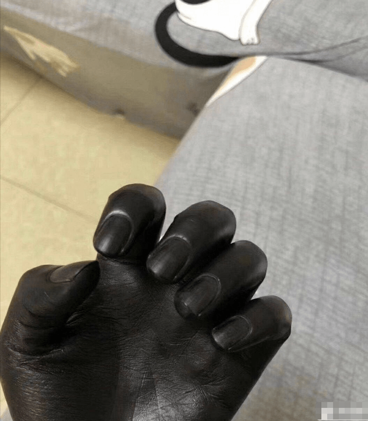 染头发的时候忘记戴手套了怎么洗不掉哈哈哈哈这是幕后黑手