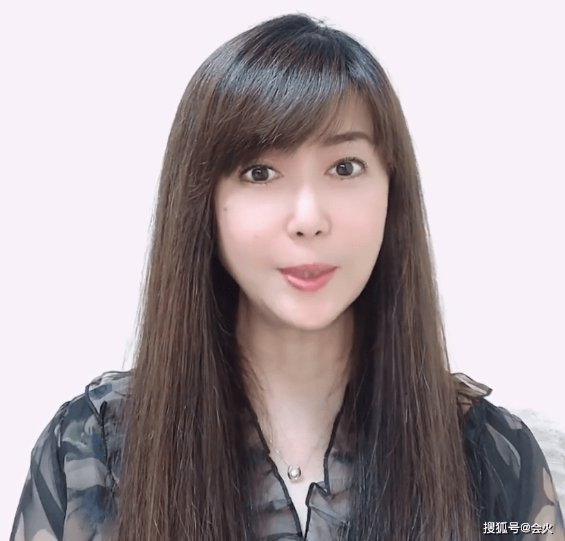 51岁孟庭苇皮肤白皙不见皱纹,网友:嘴怎么了?