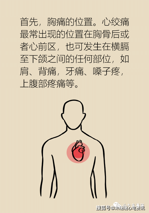 胸膜炎胸痛特点和位置图片