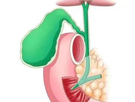 一问医答 体检发现胆囊息肉怎么办 病变