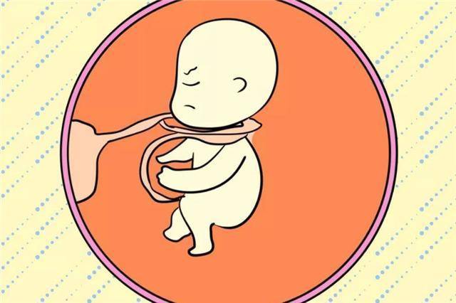 胎儿出现脐带绕颈,跟孕妇睡觉姿势有关吗?看看育儿专家的理解