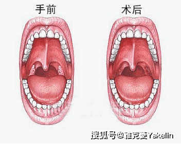 08c0679a0acd4dd6a2f7993d75fed8a4.png