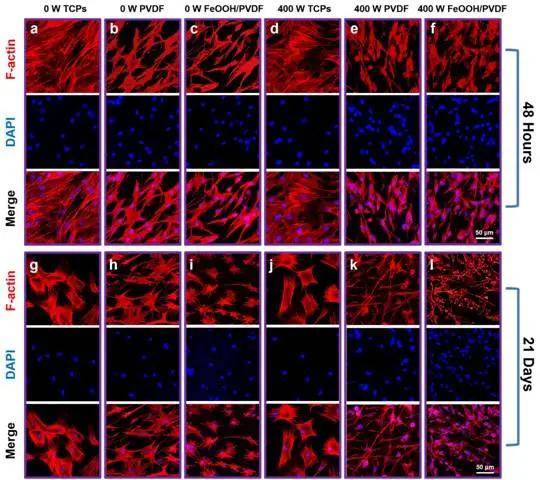 w超声功率作用条件下, 2天和21天时不同材料上接种细胞的骨架染色图