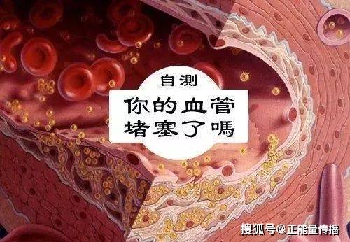 3f06257bb31649d6968afbe30f79a856.jpeg