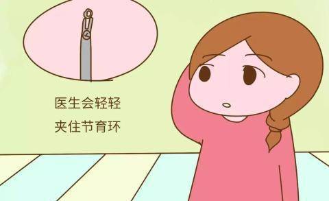 上環是女性不準備再懷孕而選擇的一種避孕的方式.