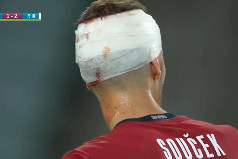 原创动容!欧洲杯大黑马是站着"死"的,2人头破血流,缠绷带继续踢