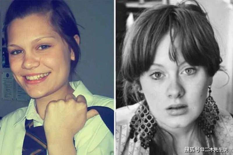 结石姐音乐天赋异禀,却被老天强开玩笑,各种疾病缠身_阿黛尔