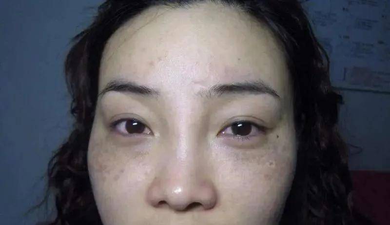 血瘀在脸上是斑,瘀在身上是病!