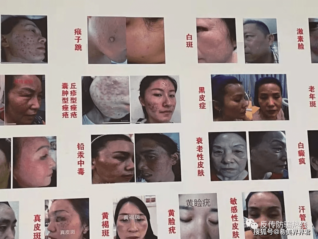 深圳市俊丽生物公司“初颜玉”代理模式被曝涉嫌传销(图3)