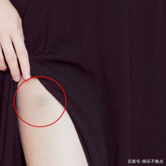 高清美|迪丽热巴穿修身高开叉裙 撩裙子大腿惊现淤青