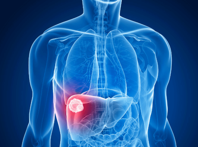 补充|乙肝别“盲治”,坚持做好3件事,攻破乙肝“帽子”