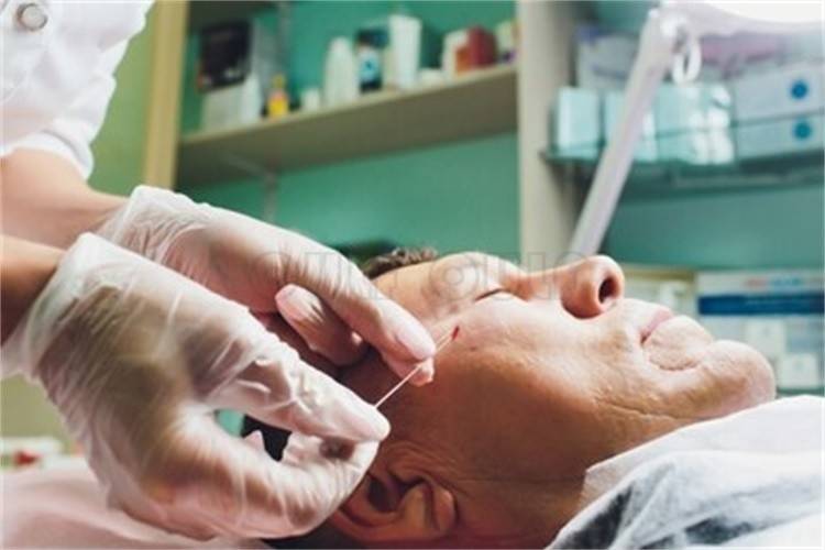 后遗症|线雕有哪些危害和后遗症、我嘞个去、吓人呐~