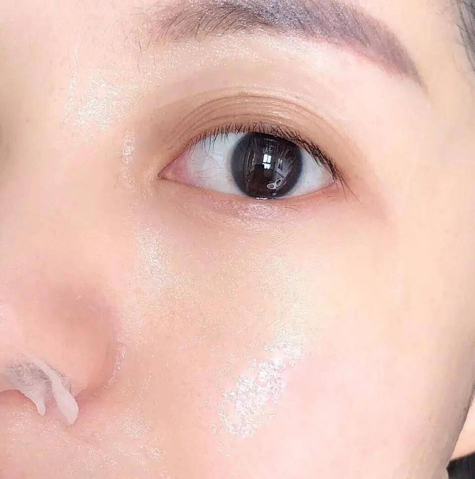 吸附力|夏天最需要的护肤品是什么？