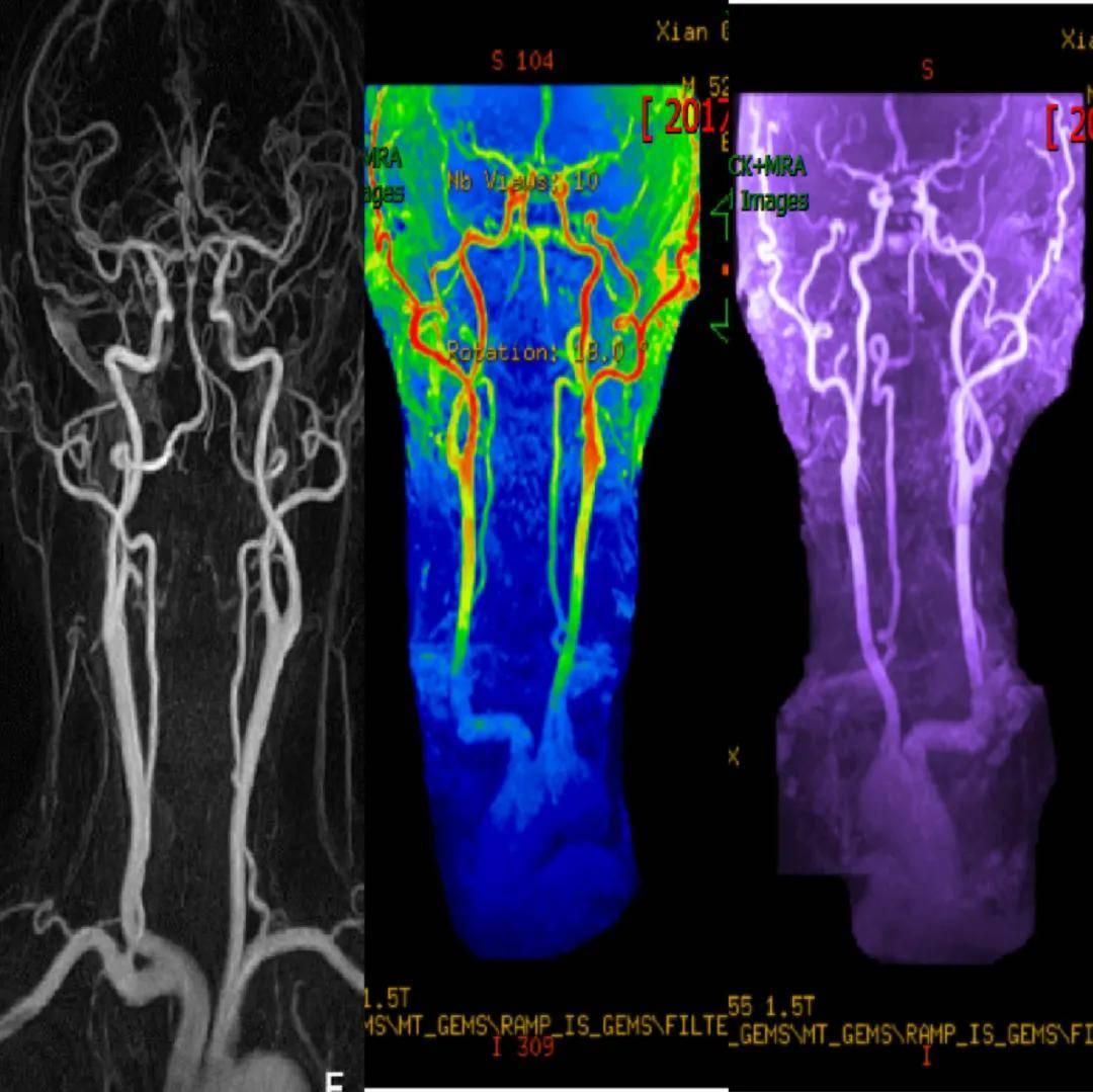 成像|【科室推荐】西安工会医院影像科