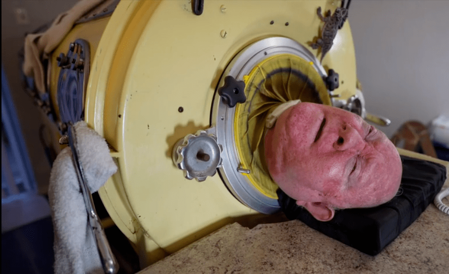 被困"铁皮棺材"69年,仅靠嘴生活…最后的"铁肺"人怎么样了?