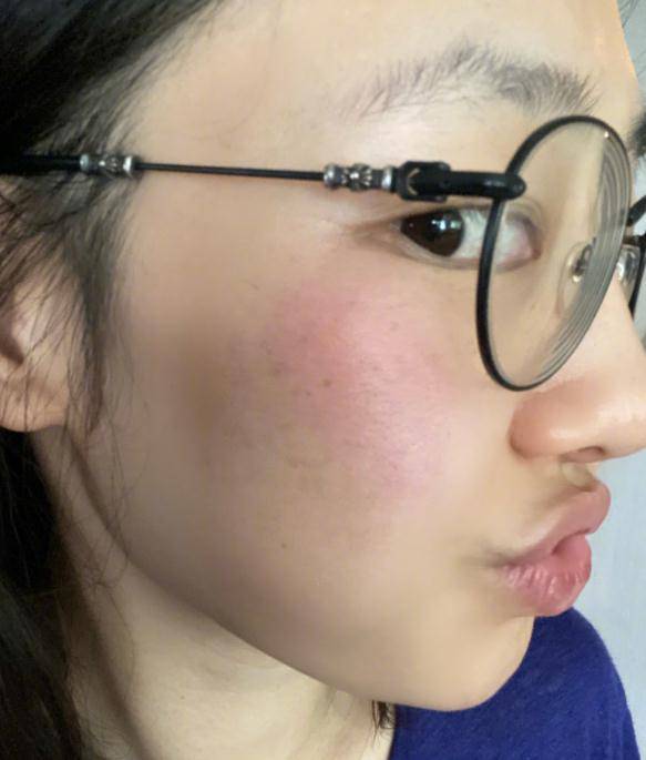 哪里可以做毛发镜 4249fbb729e044c99d149d8fb095588f.jpeg