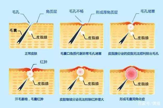 夏天|2021都夏天了，皮肤还是又老又糙，怪不得美美的露背裙轮不到你！