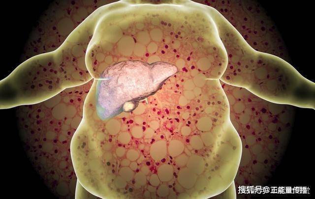 气体|肝病变并非毫无征兆，放屁若有2种“异常”，或是癌细胞已“苏醒”