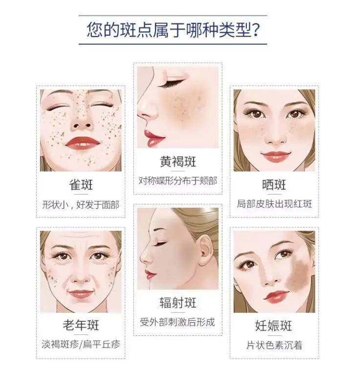 皮肤|爱兰诗 | 痘印色斑衰老接踵而至？一招轻松摆脱黄脸困扰！