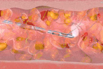 阻断|小红书上的医美种草笔记,该管管了!