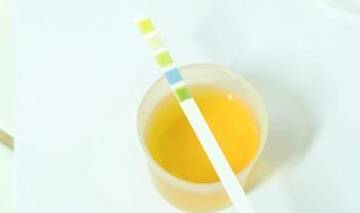 肾脏|尿液中有大量泡沫，可能是这些疾病缠上你了，不要忽视了