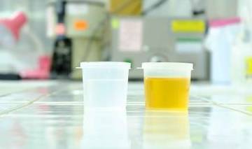 肾脏|尿液中有大量泡沫，可能是这些疾病缠上你了，不要忽视了