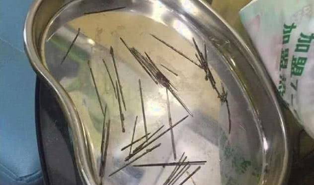 女子摸猫咪时,它表现得非常痛苦,带去医院拍片后吓坏了 女子摸猫咪时,它表现得非常痛苦,带去医院拍片后吓坏了