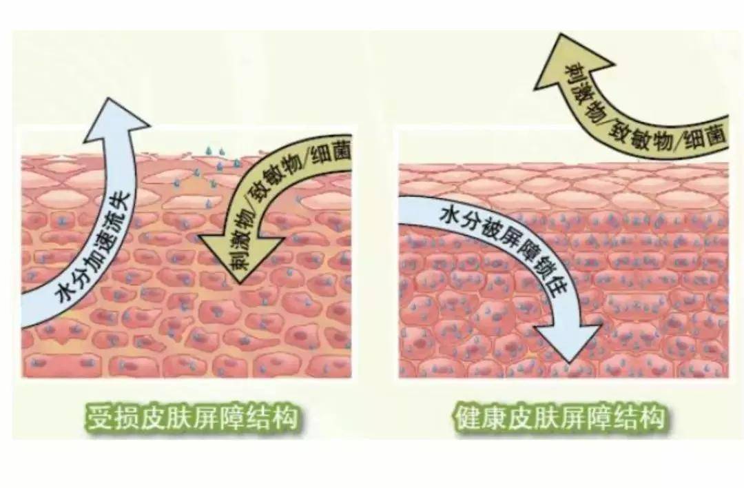 表皮层|为什么，你越补水越干？了解肌肤缺水区，事半功倍