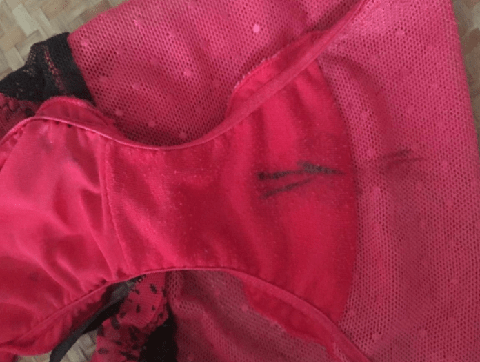 而对于底裤上的不明血迹,除了要提防月经失调导致的突然来月经之外,还