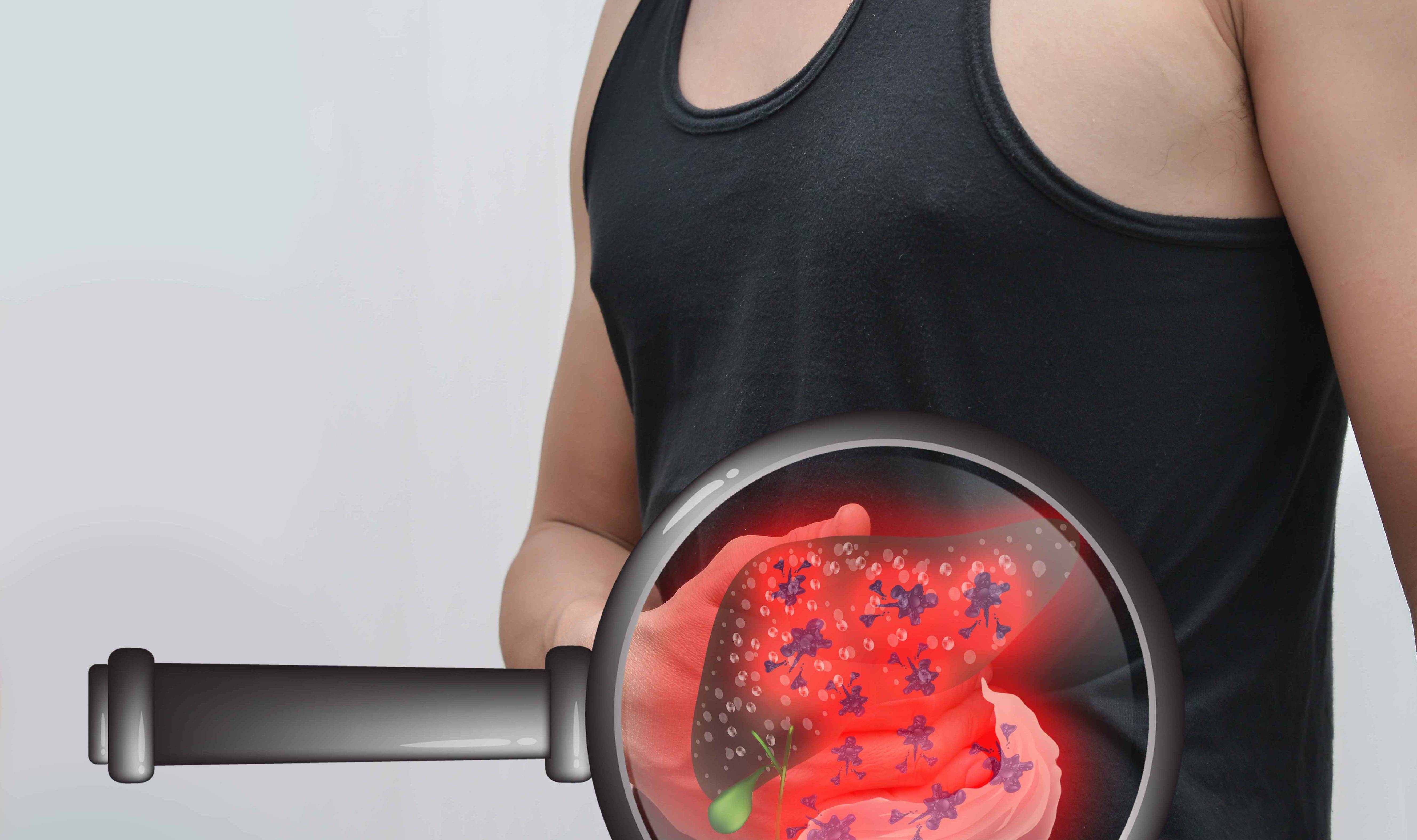 肝脏|肝病不能早期发现?身体出现“2红1黄”,警惕疾病中晚期