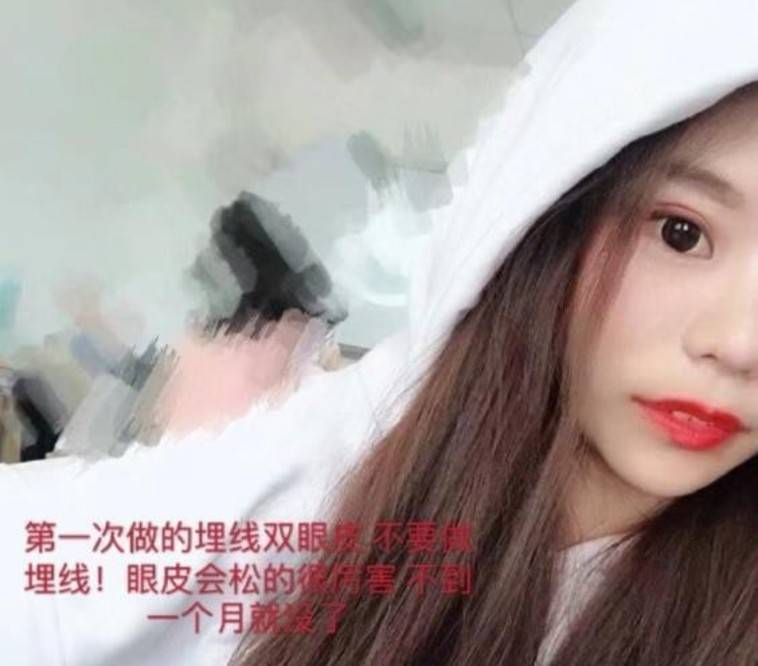 整形|女网红13岁开始整容，花费400万仍觉得不够，今后悔想做恢复手术？