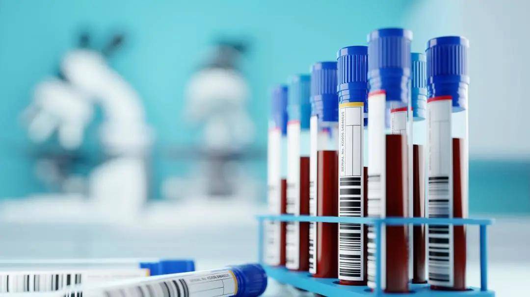 甲状腺|国康健康管家:体检报告中这些高异常指标,不用找医生,也能看懂了!