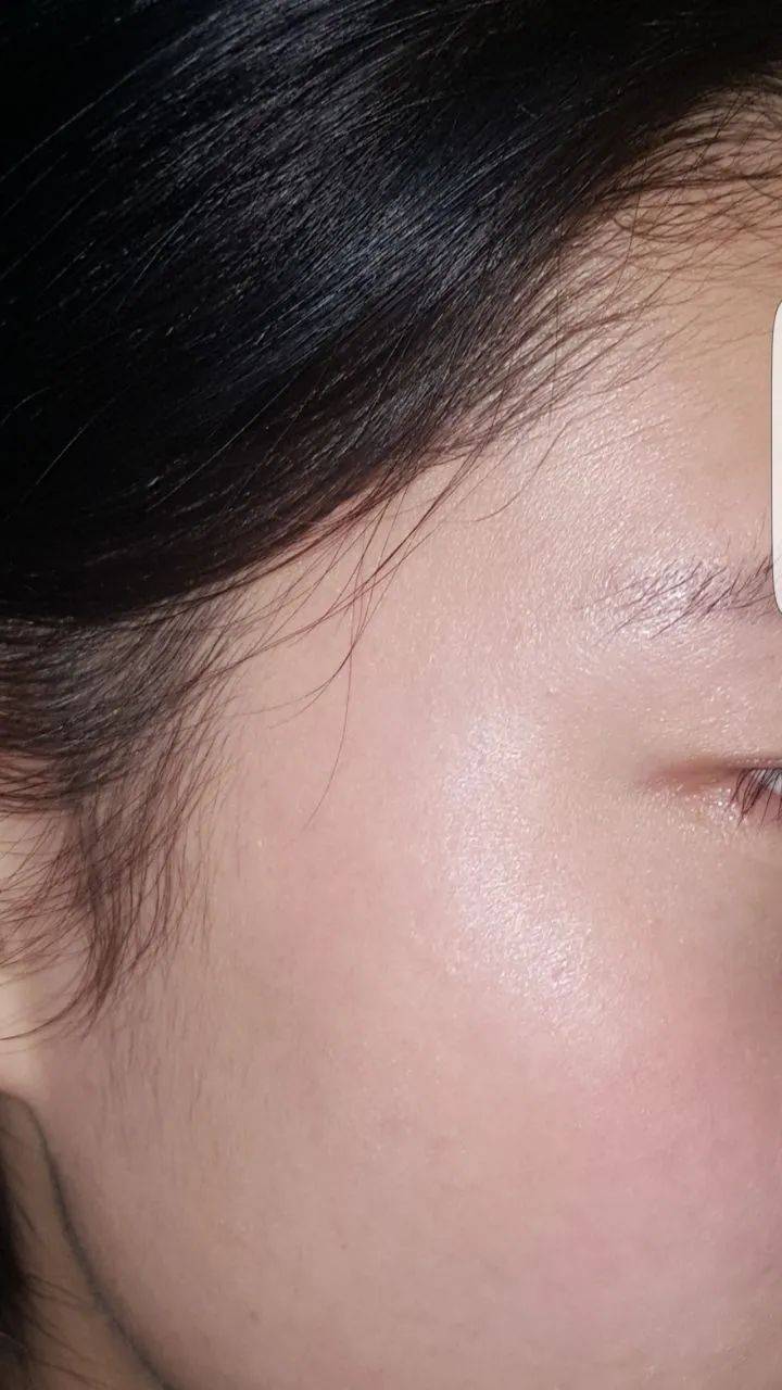 表皮层|不了解皮肤基础结构和类型，就别谈改善皮肤问题！