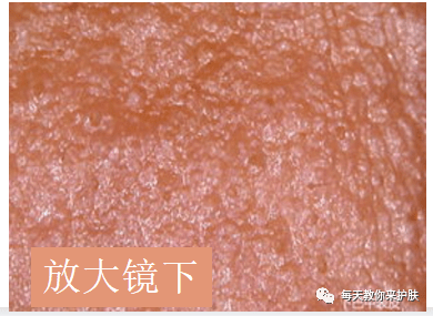方法|油性肌肤怎么做才能比现在美十倍？
