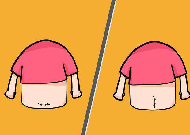 头胎|二胎选择“剖腹产”，切口会和第一胎的切口重合吗？