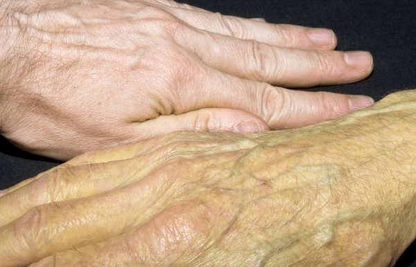 免疫|肝脏一旦生病了,身体可能会发出4个“声音”,要仔细认真听