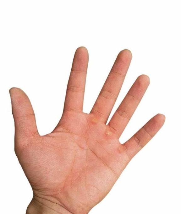 肝脏|肝脏不好,身体会有3个表现!只出现一个,也要赶紧去检查!