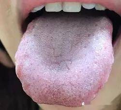 康复|瑞合康复 | 高温和湿气的双重夹击！身体出现这几种情况，你就要注意了