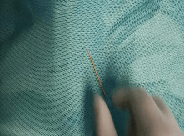 假牙|又是牙签！警惕身边的危险