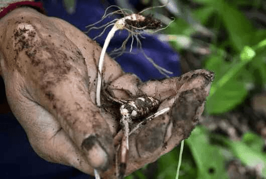 治疗|得了肝硬化，寿命就不长了？别太沮丧，抓住重点很关键